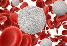 ارتفاع بسيط في lymphocytes