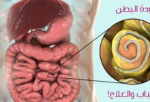 التخلص من ديدان البطن نهائيا