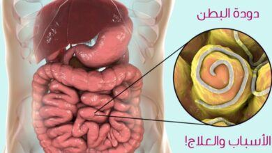 التخلص من ديدان البطن نهائيا