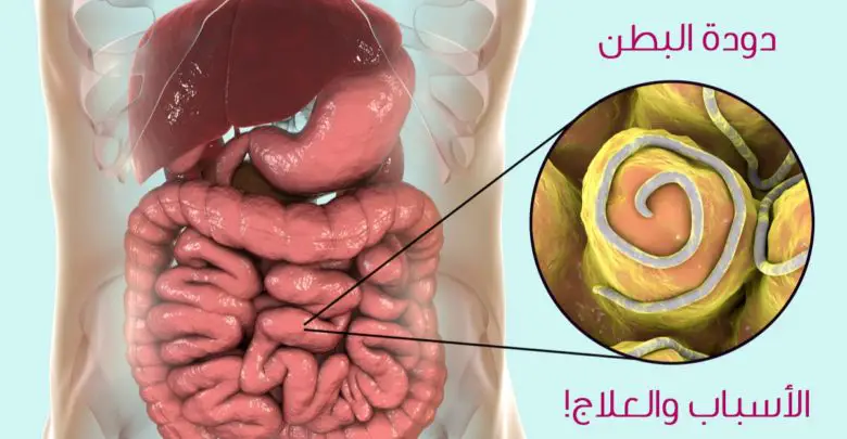 التخلص من ديدان البطن نهائيا