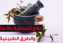 علاج الصدفية نهائيا