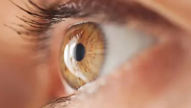 أعراض العين بعد الحجامة