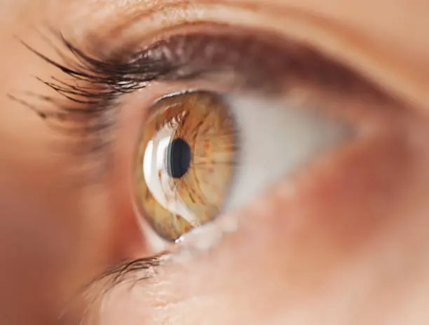 أعراض العين بعد الحجامة