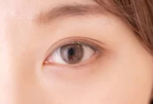 أعراض العين التراكمية